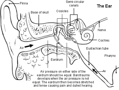 ear-barotrauma