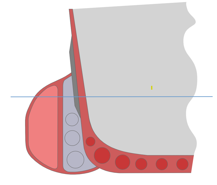 Questa immagine ha l'attributo alt vuoto; il nome del file è controcarene-anto-siluro-.png