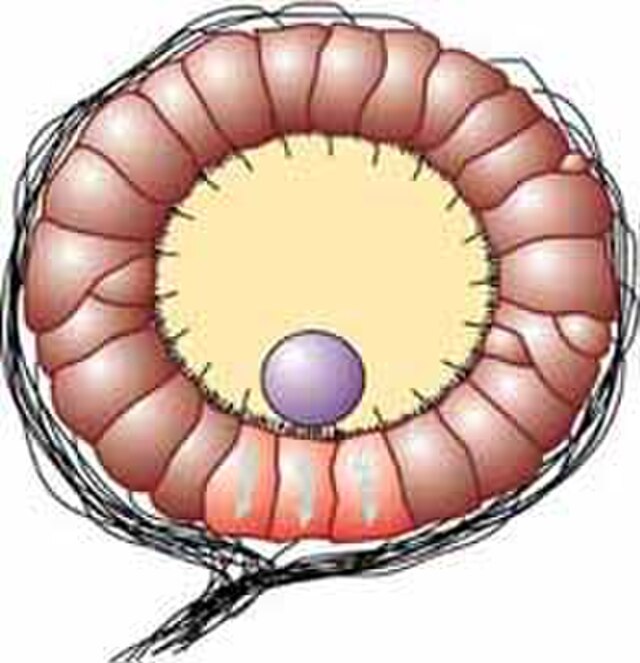 Questa immagine ha l'attributo alt vuoto; il nome del file è Statocysti.jpg